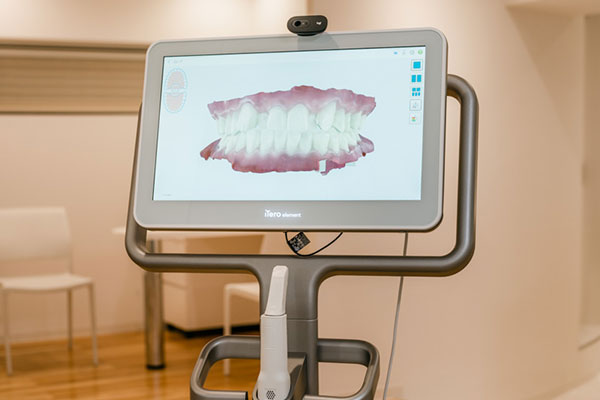iTero口腔内スキャナー