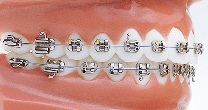 マルチブラケット装置