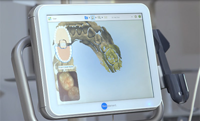 藤沢歯科ペリオ・インプラントで矯正治療を行う理由